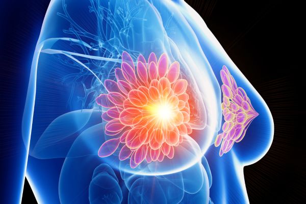 Breast and Axilla(Two Sides)