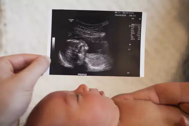Wellbeing & Growth Scan | Fetal Growth & Health Check