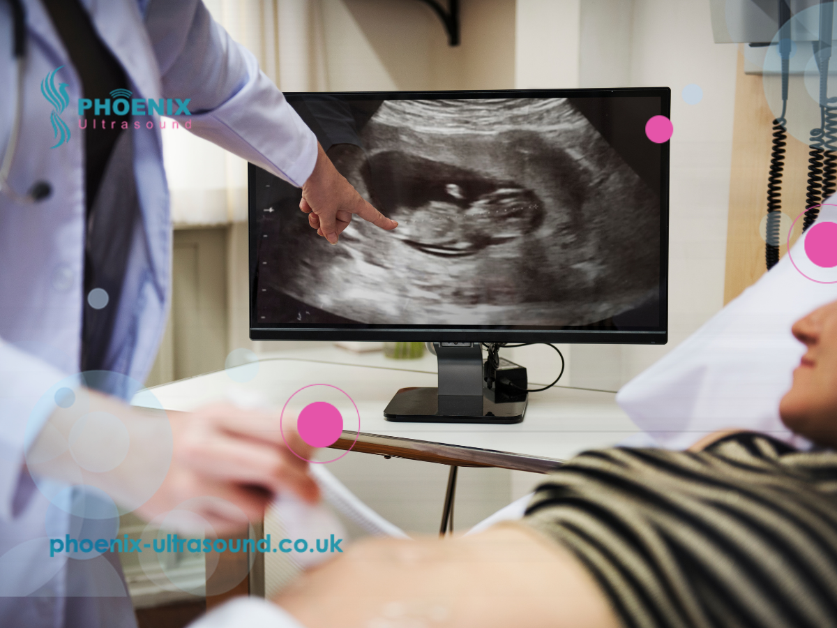 Position and Presentation Scan: 37-40 weeks